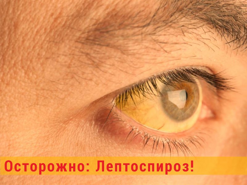 В Запорожье мужчина <i>умер от лептоспироза</i>