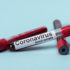 koronavirus