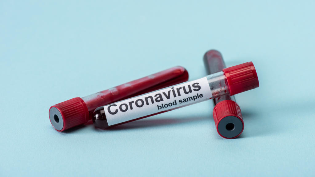 <i>В Запорожье зафиксировано</i> 64 случая COVID-19