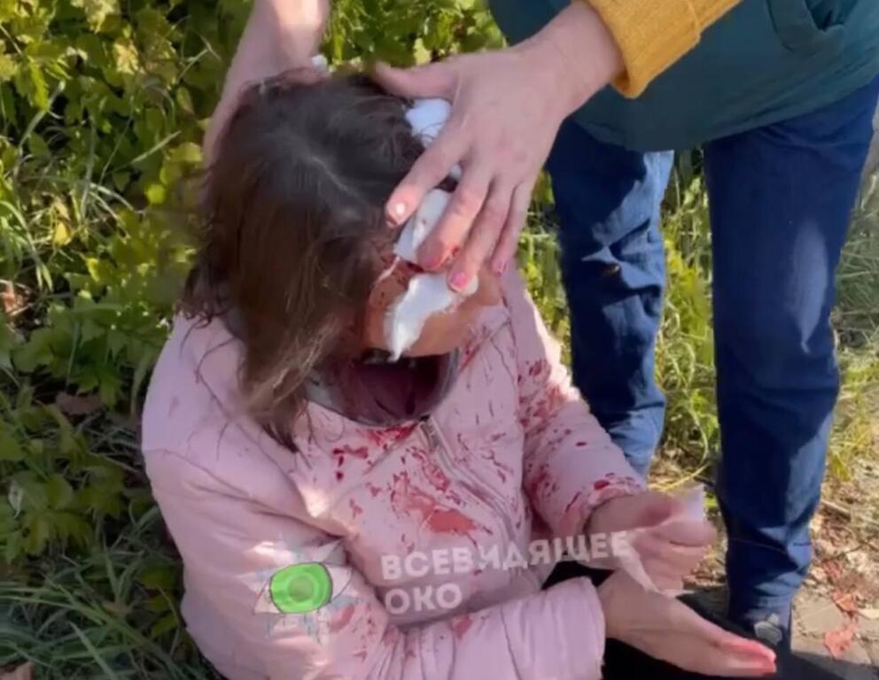 <i>Шесть ударов битой по голове: </i>в Киеве напали на женщину с ребенком, - ВИДЕО 18+