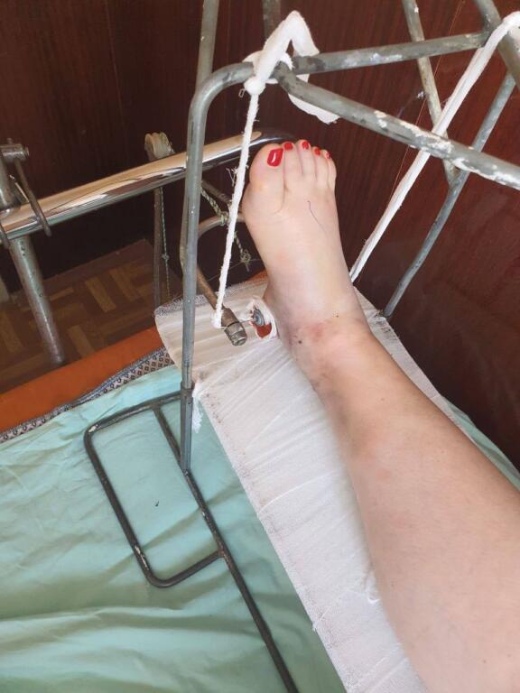 Украинская актриса и телеведущая Руслана Писанка во время спектакля получила травму, – ВИДЕО 2 272961829 166439699049344 4414206184519218691 n